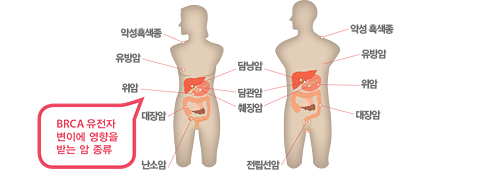 BRCA 유전자 변이에 영향을 받는 암 종류